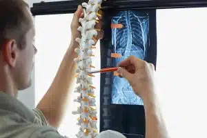 man holding skeleton model looking at an x-ray