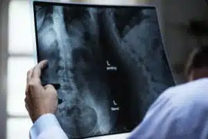 A specialist looking at a x-ray film